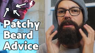 Patchy beard advice  6 insider tips for success [upl. by Ulysses]