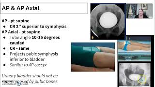 Urinary Imaging Radiology  3 Cystogram [upl. by Ayinat]