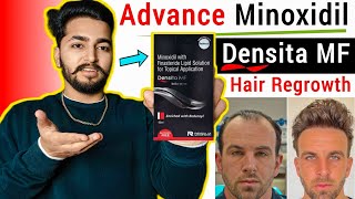 Densita MF Minoxidil Review  New Advance Minoxidil Enriched With Redensyl [upl. by Nodmac]