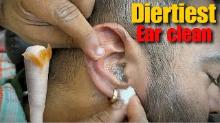 Dirtiest Ear Cleaning amp Ear Wax removal Head Massage by  Shamboo Barber  Asmr Ear Cleansing [upl. by Latashia]