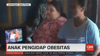 Gadis 15 Tahun Mengidap Obesitas Mencapai Berat Hampir 200 Kg [upl. by Neelie]