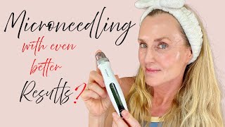 Better Results from Microneedling  New Bio Pen Q2 first impression amp full demo [upl. by Ocir]