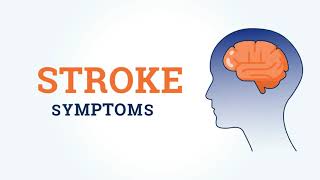 Stroke Symptoms and Signs [upl. by Froma102]