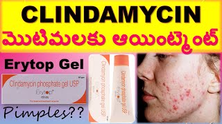 CLINDAMYCIN  ERYTOP GEL Uses Composition Working How to apply Side effects Precautions in tel [upl. by Ogir]