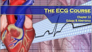 The ECG Course  Ectopy amp Aberrancy [upl. by Nrehtak]