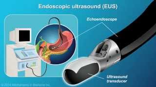 Understanding EUSFNA [upl. by Loeb]