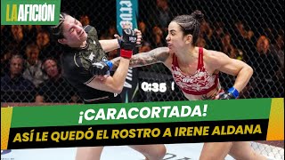 Irene Aldana sufre brutal corte en el rostro en su derrota ante a Norma Dumont [upl. by Naud]