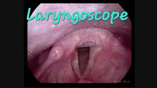 Laryngoscopy and stroboscope to examine the vocal cords  laryngoscope vocal test medical [upl. by Rocco]