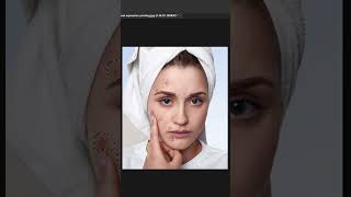 Easily Remove Skin Blemishes with Photoshops AIPowered Tool [upl. by Hewett]