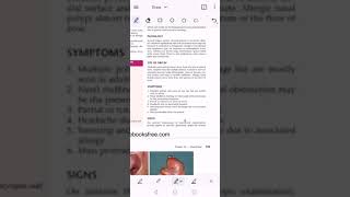 Nose  nasal polyps  Epistaxis  Trauma of face  Chap 323334  Most imp [upl. by Aerised]