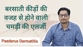 बरसाती कीड़ों की वजह से होने वाली चमड़ी की एलर्जी  Paederus Dermatitis  Blister Beetle Dermatitis [upl. by Germano]