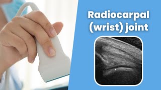 Radiocarpal wrist joint  MSKUS  How to scan the Radiocarpal wrist joint  2 minute Tuesday [upl. by Jueta]