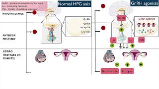 Gonadotropinreleasing hormone GnRH agonists [upl. by Vivian18]