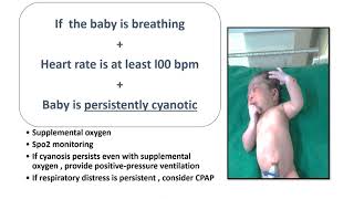 Neonatal Resuscitation Part3  2020 AAP Guidelines  Positive Pressure Ventilation StepB [upl. by Borchers656]