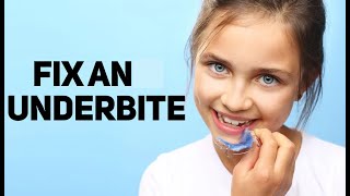 How to Fix and Underbite in a Growing Child httpswwwstraightsmilesolutionscom [upl. by Naivat899]