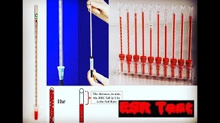 Erythrocyte Sedimentation Rate ESR Test [upl. by Josephson]