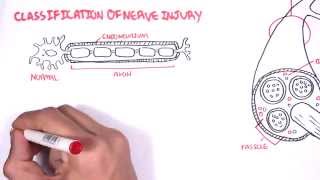 Neurology  Nerve Damage and Regeneration [upl. by Eilloh]