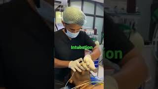 endotracheal intubation [upl. by Dygert]