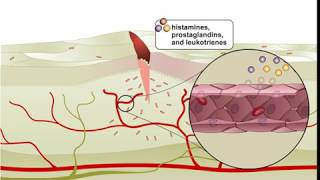 Inflammation Full Animation Video  ScienceRoot [upl. by Xuerd300]