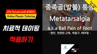 중족골통증 발볼통증Metatarsalgia 치료적 테이핑 적용하기 중족골통증 발볼통증 metatarsalgia footpain kinesiotape 통증완화 [upl. by Christabella]