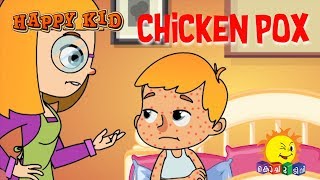 Happy Kid  Chicken Pox  Episode 41  Kochu TV  Malayalam [upl. by Akit]