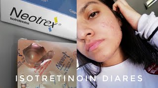 Mi experiencia tomando Isotretinoina  Diane Reyes [upl. by Berlin790]