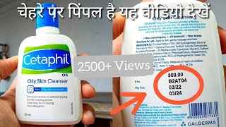 Cetaphil Oily Skin Cleanser Review in Hindi  How To Use  Oil Remover  Solution Of Oily Skin [upl. by Diley616]