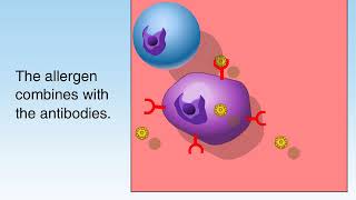 How Allergies Work Animation Understanding Allergic Reaction Immune System Video Symptom Treatment [upl. by Dalpe]