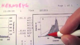 chernobyl 2012 albedo personal dosimeter dose report vs brazil holiday radiation [upl. by Nyre]