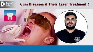 LASER Treatment for Bleeding Gums Gum Diseases amp Gum Pockets  DrParikshith H M  Doctors’ Circle [upl. by Einavoj]