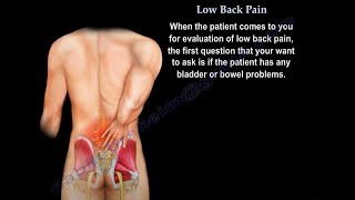 Low Back pain causes diagnosis imaging and treatment [upl. by Ahsahs]