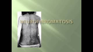 Neurofibromatosis Skin Examination mrcpch Clinical [upl. by Eirena]