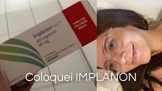 Como é colocar IMPLANON método contraceptivo [upl. by Eduardo169]