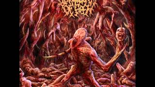 Disfigurement Of Flesh  Carnivorous Intestinal Worms [upl. by Bobbette949]