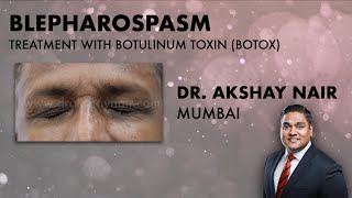 Understanding Blepharospasm Treatment  Botulinum Toxins Dr Akshay Nair Mumbai [upl. by Plank]