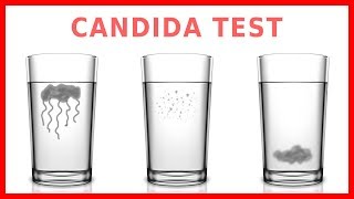 Do You Have Candida Take The quotSpit Testquot [upl. by Georgena927]