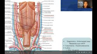 Hiperparatiroidismo Primario  López Ramos María Fernanda 2AZ1 [upl. by Earezed]
