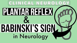 PLANTAR REFLEX  BABINSKIs SIGN  Equivocal Plantar  Other methods  Clinical Neurology [upl. by Stearn]