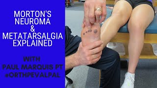 Mortons Neuroma and Metatarsalgia Whats the Difference [upl. by Yankee526]