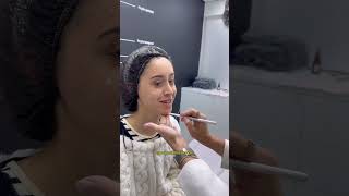 Fiz minha PRIMEIRA HARMONIZAÇÃO FACIAL 💉glowup procedimentos [upl. by Sitoiyanap]