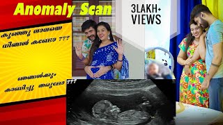 Anomaly scan  കുഞ്ഞുവാവയെ കണ്ടാലോ  pregnancy Hospital Vlog   sheethal elzha official  sheethal [upl. by Cagle499]