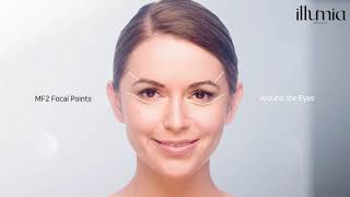 Ultraformer 3 HIFU for Facelift and Fat Reduction by Illumia Medical [upl. by Ignatia]