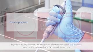 HBA SpermHyaluronan Binding Assay [upl. by Booma738]