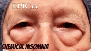 Epica  Chemical Insomnia Live FIRST TIME REACTION [upl. by Allmon]