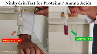 Ninhydrin Test [upl. by Nueoras]