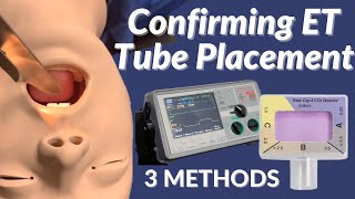 How to Confirm ET Tube Placement 3 Methods [upl. by Stedt751]