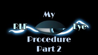 RLE Procedure Part 2 [upl. by Arykahs187]