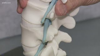 New procedure gives instant relief for spinal stenosis [upl. by Aloap]