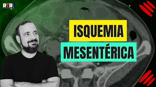 Isquemia mesentérica  José Góes [upl. by Zinck]