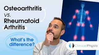 Osteoarthritis vs Rheumatoid Arthritis  Whats the Difference [upl. by Siletotsira395]